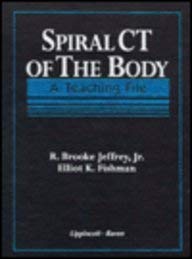 Spiral CT Of The Body: A Teaching File